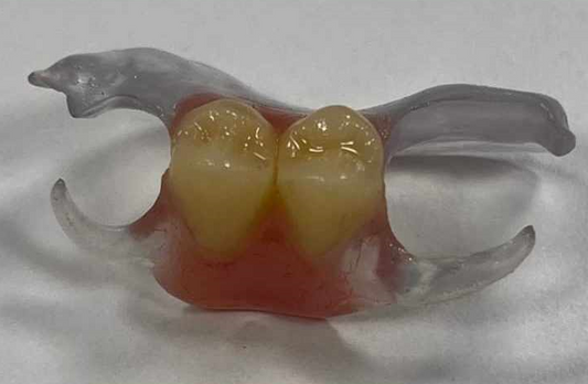 Clear-Pink Nesbit | Partial Denture