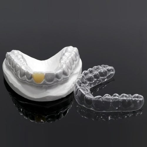 Essix Rretainer Clear Essix Pontic Retainer – Direct Dental Prosthetics