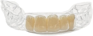 Clear Essix Pontic Retainer – Direct Dental Prosthetics
