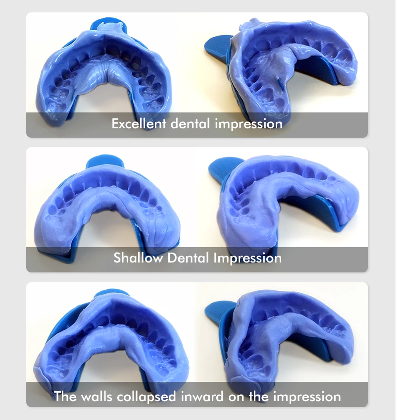 At Home Dental Impression Kit Direct Dental Prosthetics   HowtoUseExamples 