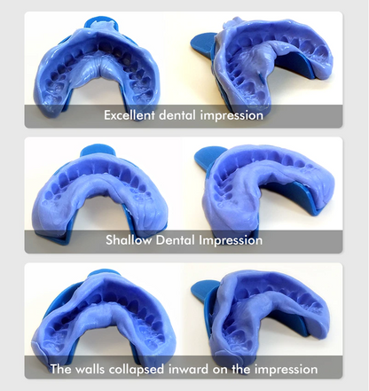 At-Home Dental Impression Kit